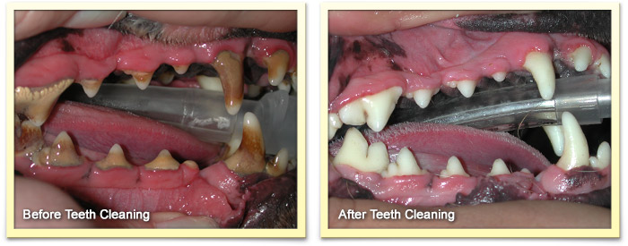 Dental Before and After Cleaning